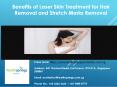 Benefits of Laser Skin Treatment for Hair Removal and Stretch Mark Removal PowerPoint PPT Presentation