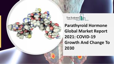 Parathyroid Hormone Market Growth - Industry Analysis, Size, Share, Trends, Demand, Overview and Segment Forecast To 2030