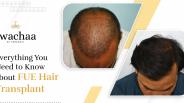An Insight to Follicular Unit Excision (FUE) Hair Transplant