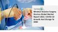 Global Minimal Invasive Surgery Devices Market Insights, Trends Sales, Supply, Demand 2021-2030 PowerPoint PPT Presentation