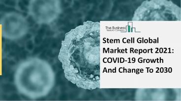 Stem Cell Market 2021- Revenue Analysis, Growth, Trends, Segmentation and Regional Forecast 2030