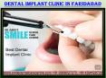 How Can I Get Best Dental Implant Clinic in Faridabad? PowerPoint PPT Presentation
