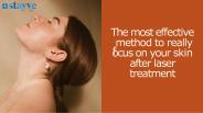 What To Do After Laser Treatment?