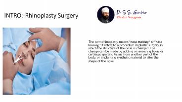 rhinoplasty surgery in delhi | Dr. Gambhir