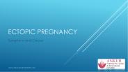 Learn about Ectopic Pregnancy