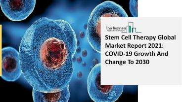 2021 Stem Cell Therapy Market Growth Analysis, Size, Share, Trends And Forecast To 2030