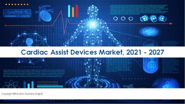Cardiac Assist Devices Market 2021 Competitive Analysis