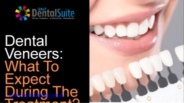 Affordable Veneers Blacktown