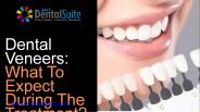 Affordable Veneers Blacktown