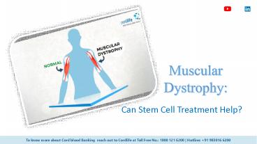 Muscular Dystrophy: Can Stem Cell Treatment Help?