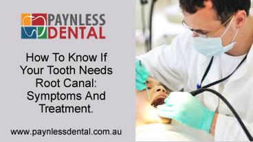 Root Canal Treatment In Toongabbie