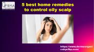 5 best home remedies to control oily scalp