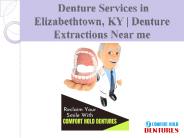 Denture Services in Elizabethtown, KY | Denture Extractions Near me