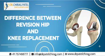 Difference between Revision Hip and Knee Replacement | Dr Chirag Patel