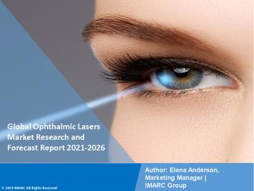 Ophthalmic Lasers Market PPT (2021-2026): Global Trends, Scope, Demand, Opportunity and Forecast by 2026