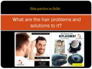 What are the hair problems and solutions to it?