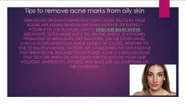 Tips to remove acne marks from oily skin
