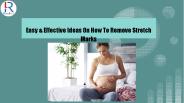 How To Remove Stretch Marks