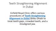 Teeth Straightening Alignment in Dubai