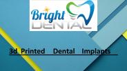 3d Printed Dental Implants