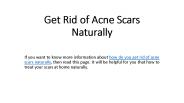 Get Rid of Acne Scars Naturally