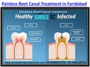 Painless Root Canal Treatment in Affordable Price in Faridabad