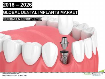 Global Dental Implants Market Size, Share, Trend and Forecast 2026 | TechSci Research