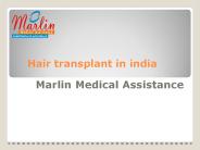 Hair transplant in india