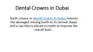 Dental Crowns in Dubai