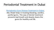 Periodontal Treatment in Dubai