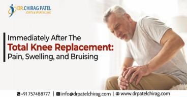 Immediately After The Total Knee Replacement: Pain, Swelling, and Bruising | Dr Chirag Patel