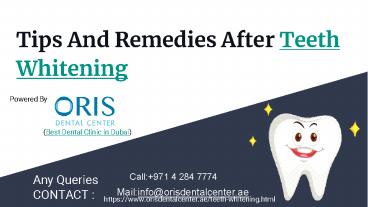 Tips and Remedies After You Whitening Your Teeth