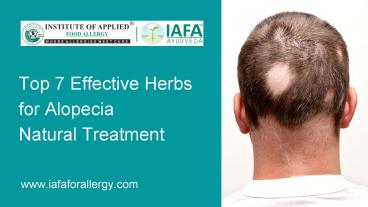 Top 7 Effective Herbs for Alopecia Natural Treatment