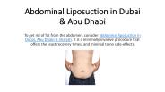 Abdominal liposuction Cost in Dubai