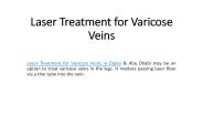Laser Treatment for Varicose Veins