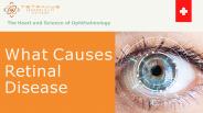 What Causes Retinal Disease