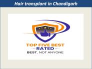 Hair transplant in chandigarh