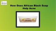 How Does African Black Soap Help Acne