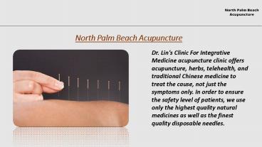Best Acupuncturist In North Palm Beach | North Palm Beach Acupuncture