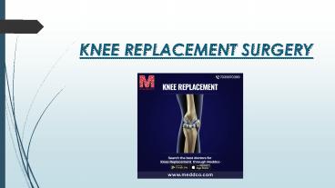 Knee Replacement Surgery - Meddco