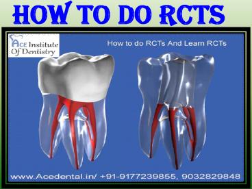 Learn RCTs in India at Affordable Institute in Hyderabad