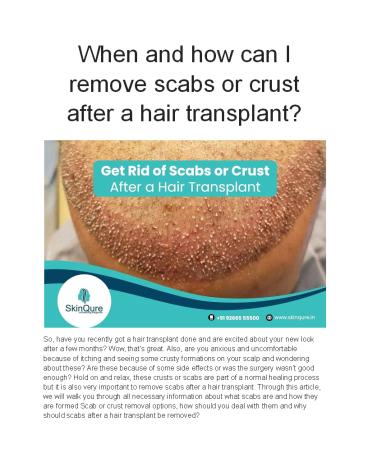 When and how can I remove scabs or crust after a hair transplant?