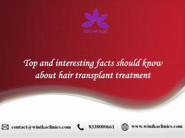 Top and interesting facts should know about hair transplant treatment