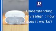 Understanding Invisalign: How does it works?