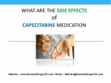 Do You Lose Your Hair With CAPECITABINE?