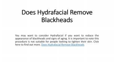 Does Hydrafacial Remove Blackheads?
