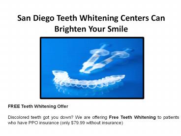 San Diego Teeth Whitening Centers Can Brighten Your Smile