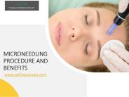 Micro-Needling Procedure and Benefits
