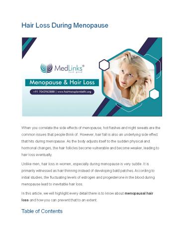 Hair Loss During Menopause - hairtransplantdelhi