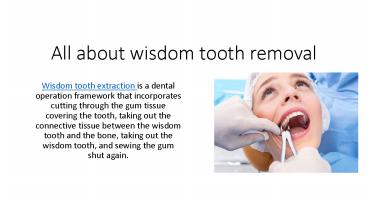 wisdom tooth extraction